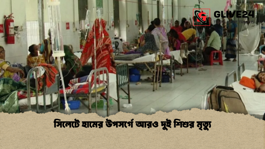 সিলেটে হামের উপসর্গে আরও দুই শিশুর মৃত্যু সিলেটে হামের উপসর্গে আরও দুই শিশুর মৃত্যু
