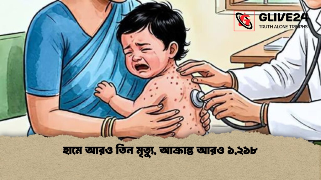 হামে আরও তিন মৃত্যু আক্রান্ত আরও ১২১৮ হামে আরও তিন মৃত্যু, আক্রান্ত আরও ১,২১৮