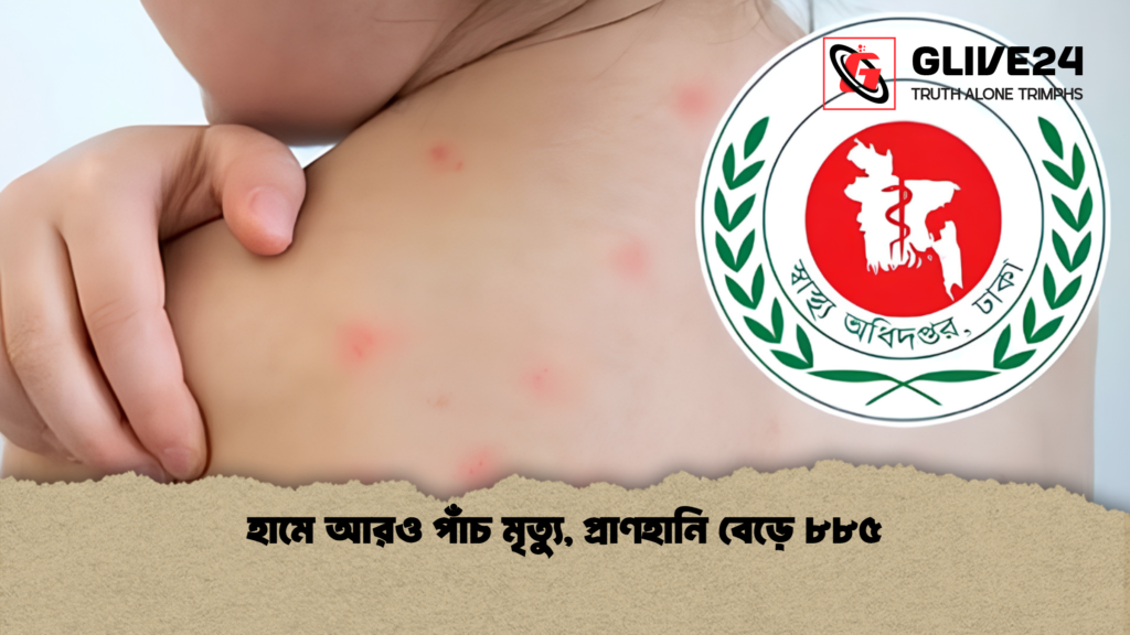 হামে আরও পাঁচ মৃত্যু প্রাণহানি বেড়ে ৮৮৫ 1 হামে আরও পাঁচ মৃত্যু, প্রাণহানি বেড়ে ৮৮৫