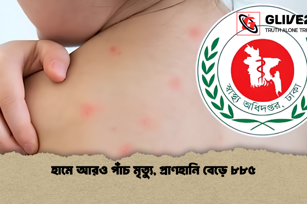 হামে আরও পাঁচ মৃত্যু, প্রাণহানি বেড়ে ৮৮৫