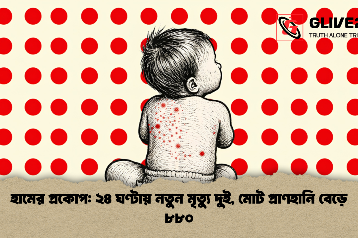 হামের প্রকোপ: ২৪ ঘণ্টায় নতুন মৃত্যু দুই, মোট প্রাণহানি বেড়ে ৮৮০