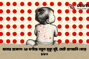 হামের প্রকোপ: ২৪ ঘণ্টায় নতুন মৃত্যু দুই, মোট প্রাণহানি বেড়ে ৮৮০