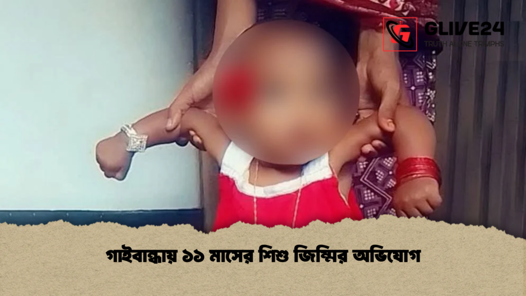 গাইবান্ধায় ১১ মাসের শিশু জিম্মির অভিযোগ