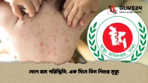 দেশে হাম পরিস্থিতি এক দিনে তিন শিশুর মৃত্যু দেশে হাম পরিস্থিতি, এক দিনে তিন শিশুর মৃত্যু