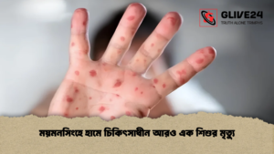 ময়মনসিংহে হামে চিকিৎসাধীন আরও এক শিশুর মৃত্যু