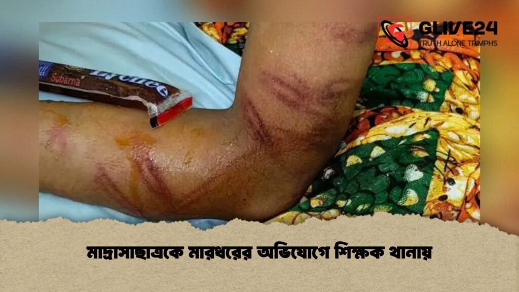 মাদ্রাসাছাত্রকে মারধরের অভিযোগে শিক্ষক থানায়
