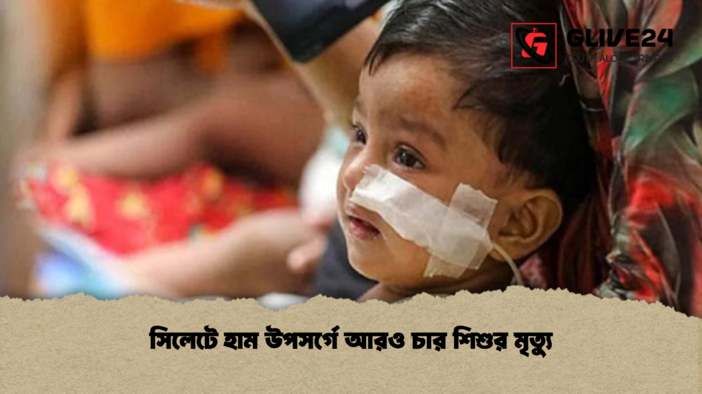 সিলেটে হাম উপসর্গে আরও চার শিশুর মৃত্যু
