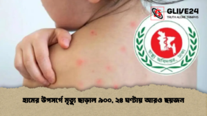 হামের উপসর্গে মৃত্যু ছাড়াল ৯০০, ২৪ ঘণ্টায় আরও ছয়জন