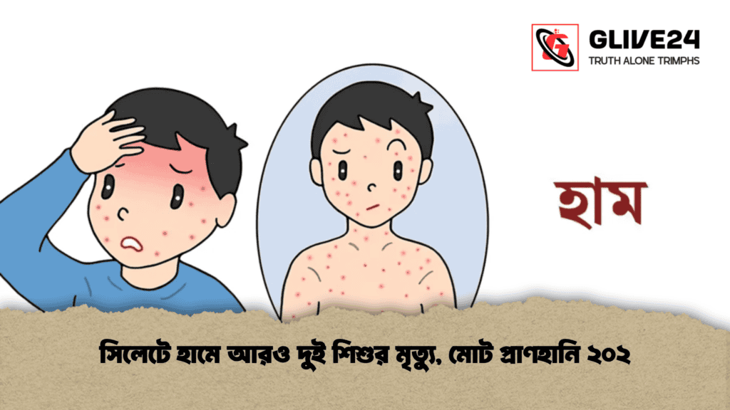 সিলেটে হামে আরও দুই শিশুর মৃত্যু, মোট প্রাণহানি ২০২ 3 সিলেটে হামে আরও দুই শিশুর মৃত্যু, মোট প্রাণহানি ২০২